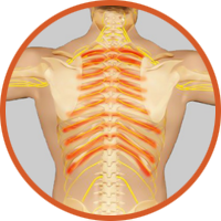 Đau dây thần kinh liên sườn